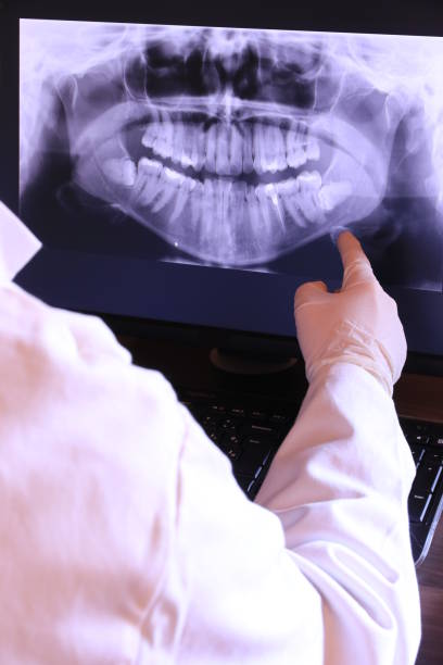 Best Emergency Dental Care for Broken or Chipped Teeth in Spanish Fork, UT